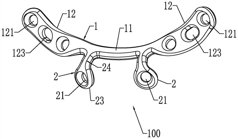 Pressurizing anatomical bone fracture plate for symphysis pubis orthopedic