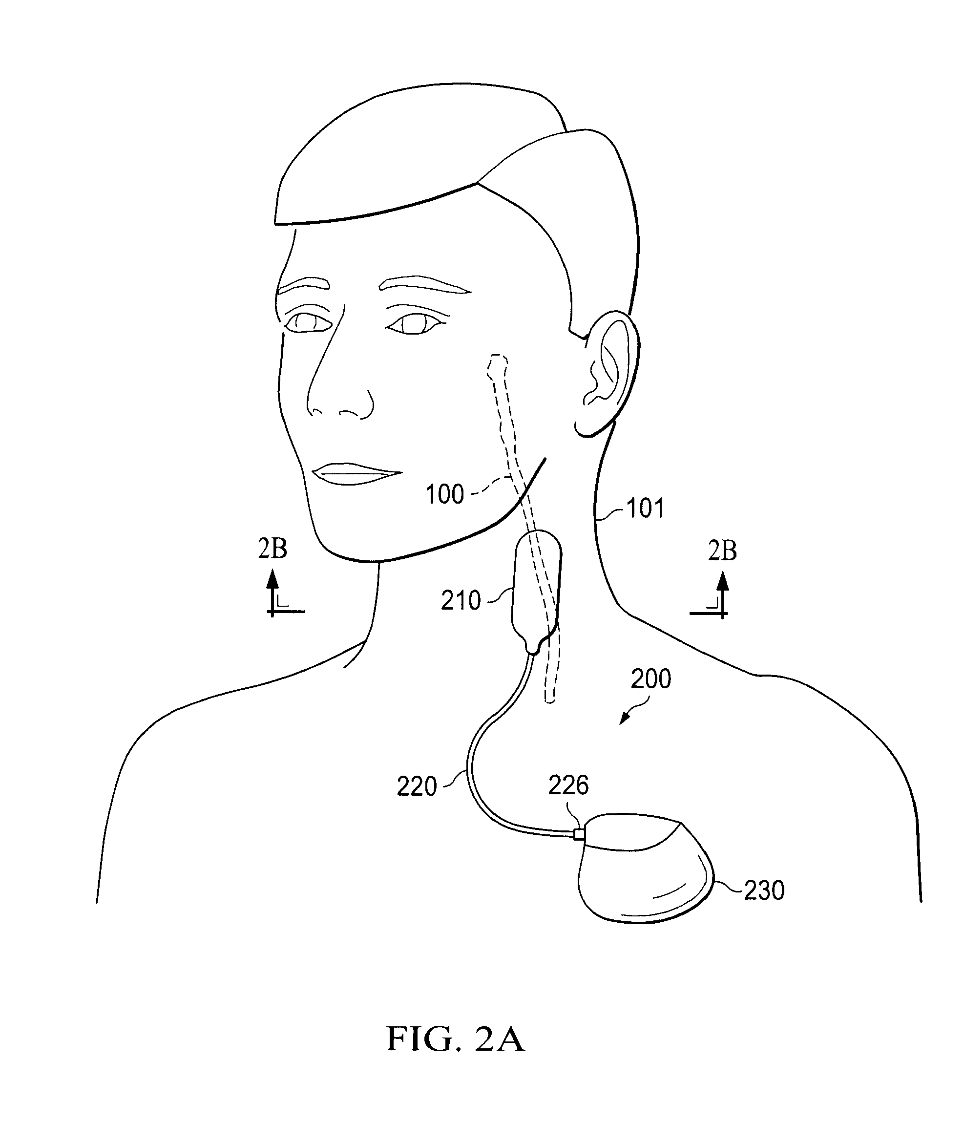 Devices and Methods for Screening of Vagal Nerve Stimulation