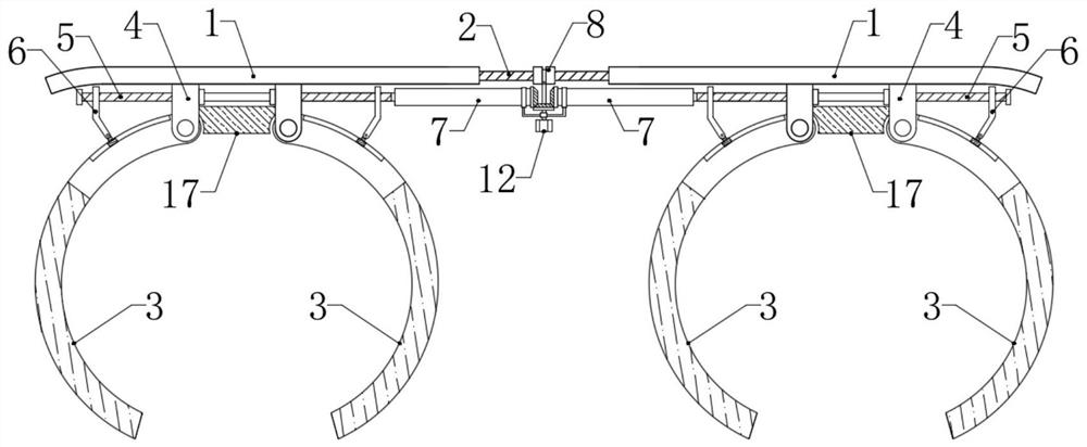 Extravascular stent for kidney transplantation