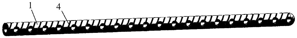 Integrated injection implementation method and device of injectable bone substitute in vertebral body molding