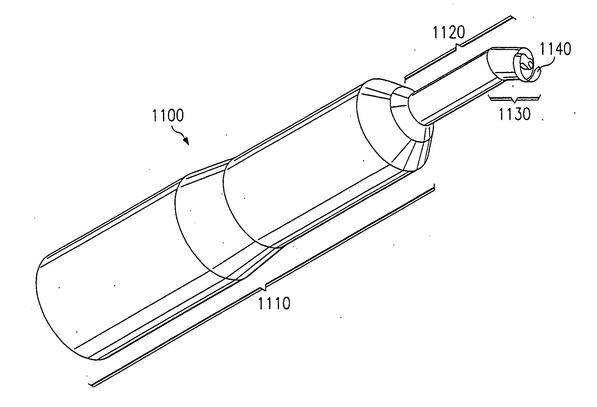 System and method for making incisions for scleral eye implants