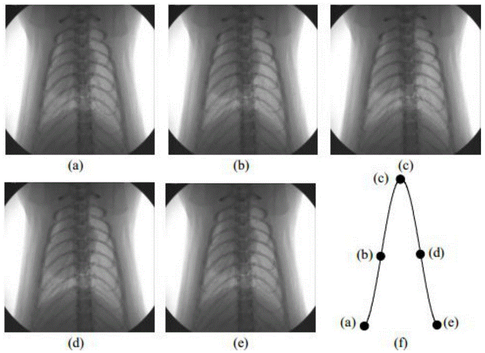 Full automatic inner retrospective CT respiratory gating system