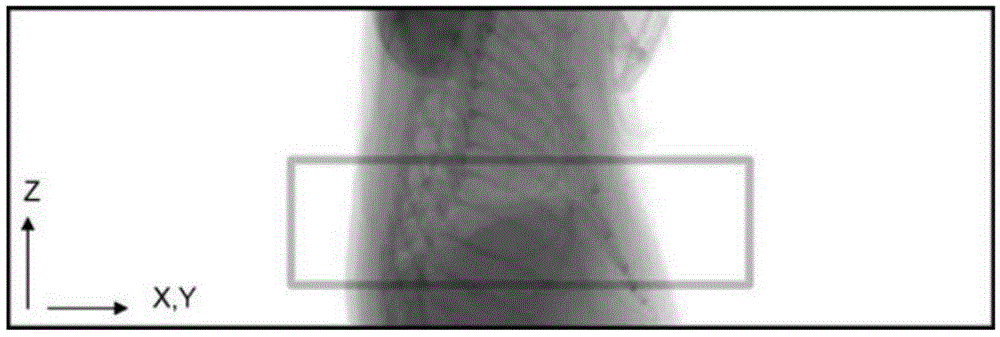 Full automatic inner retrospective CT respiratory gating system