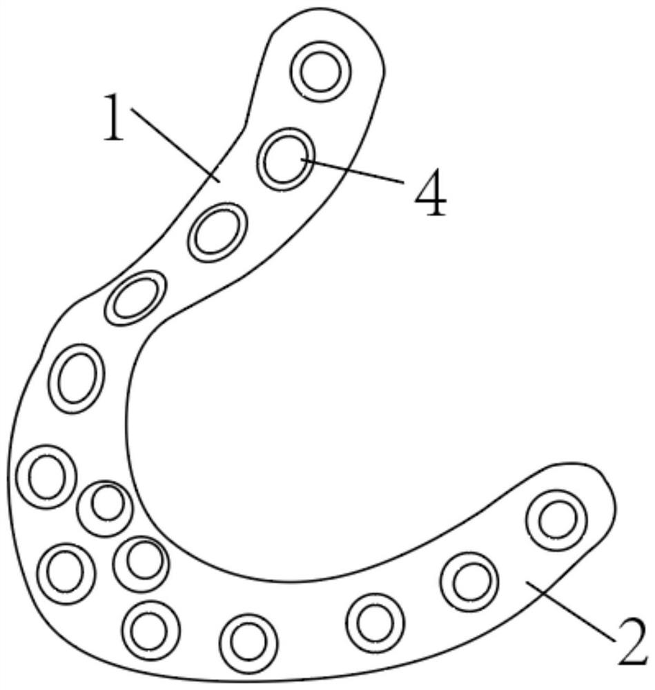 Hoffa anatomical steel plate