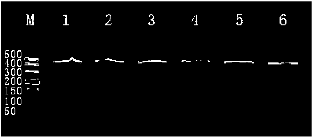 HLA related SNP marker and detection primer pair and determination method thereof