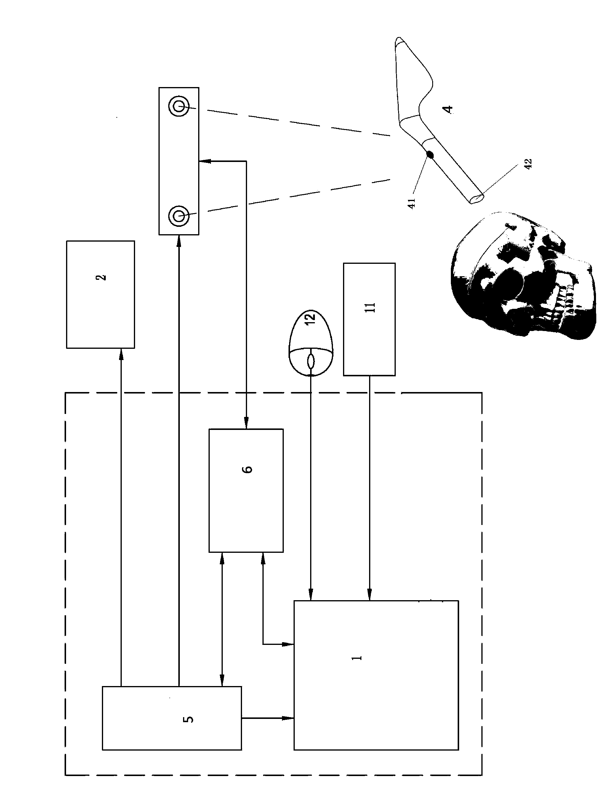 Surgical navigation system employing wireless face registration and face registration signal acquisition method