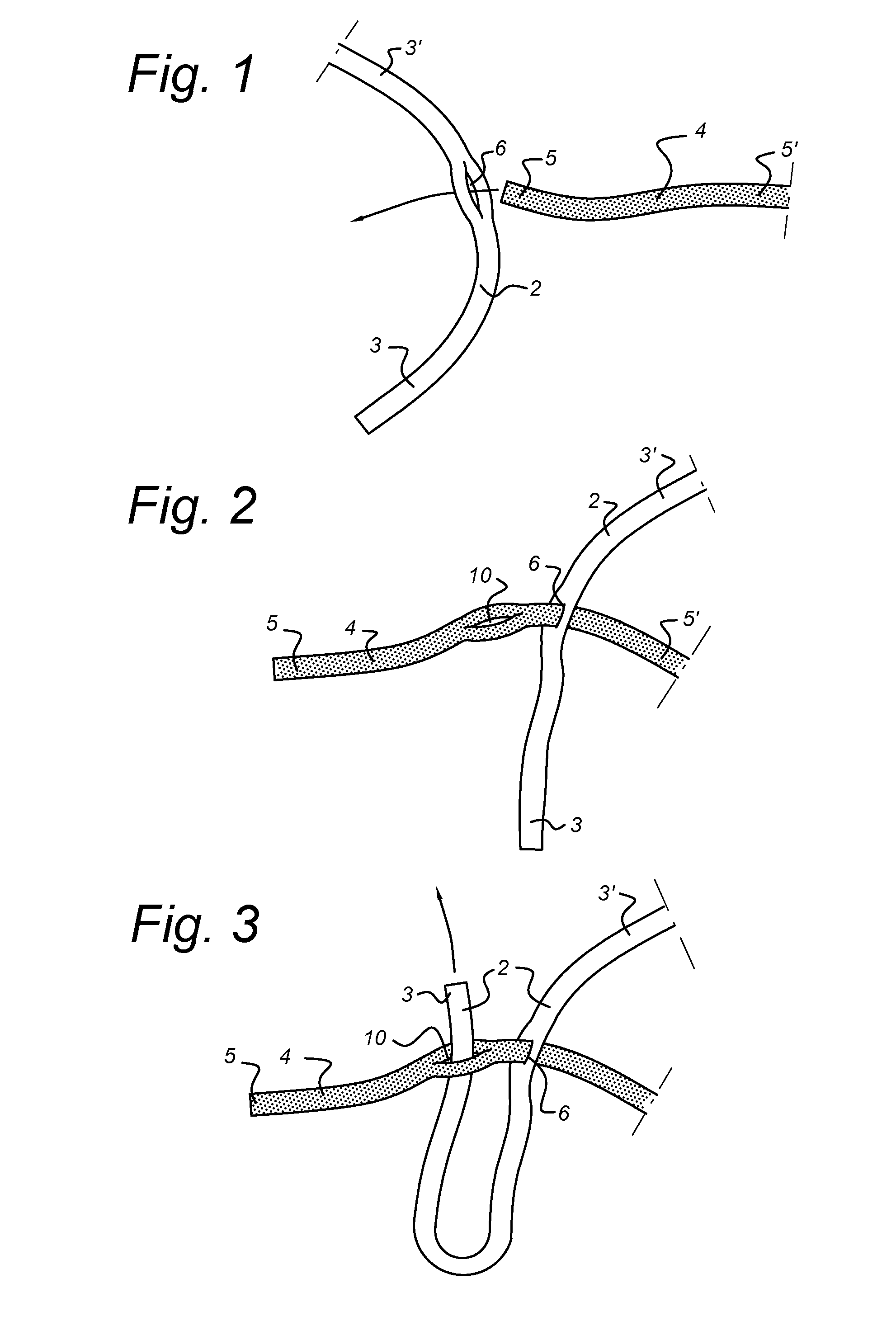 Net and a method of making the same