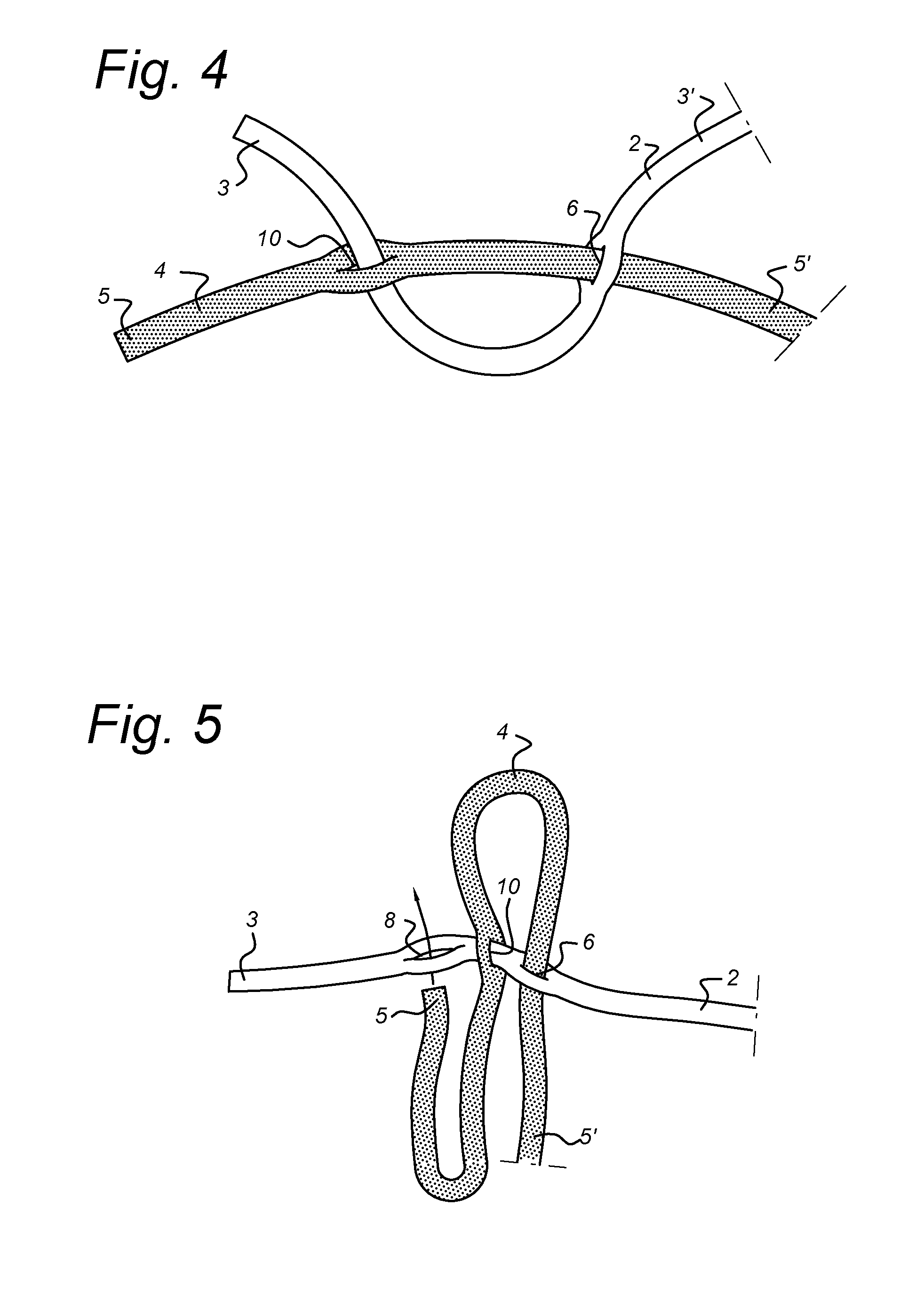 Net and a method of making the same