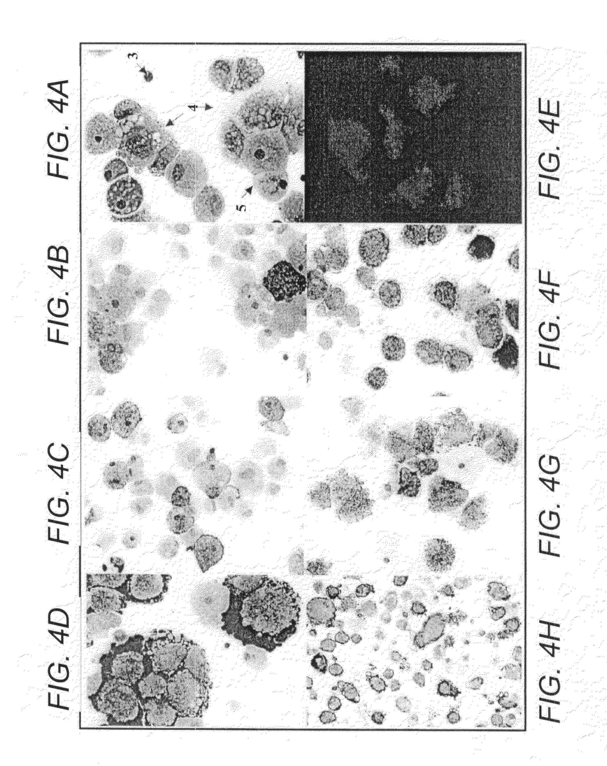 Method for preventing, or reducing the severity of, graft-versus-host disease using pluri-differentiated mesenchymal progenitor cells