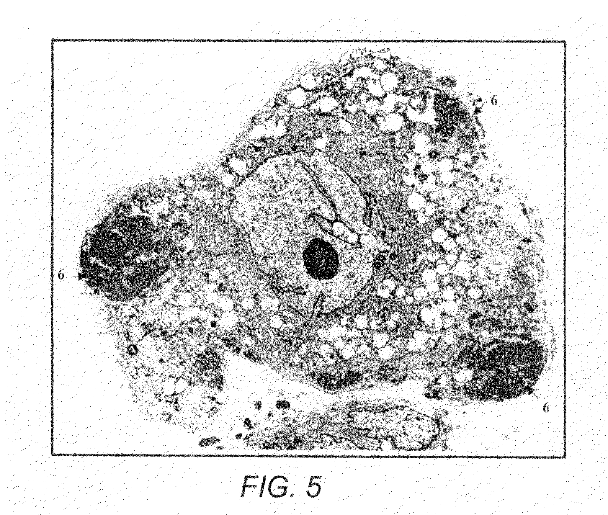 Method for preventing, or reducing the severity of, graft-versus-host disease using pluri-differentiated mesenchymal progenitor cells