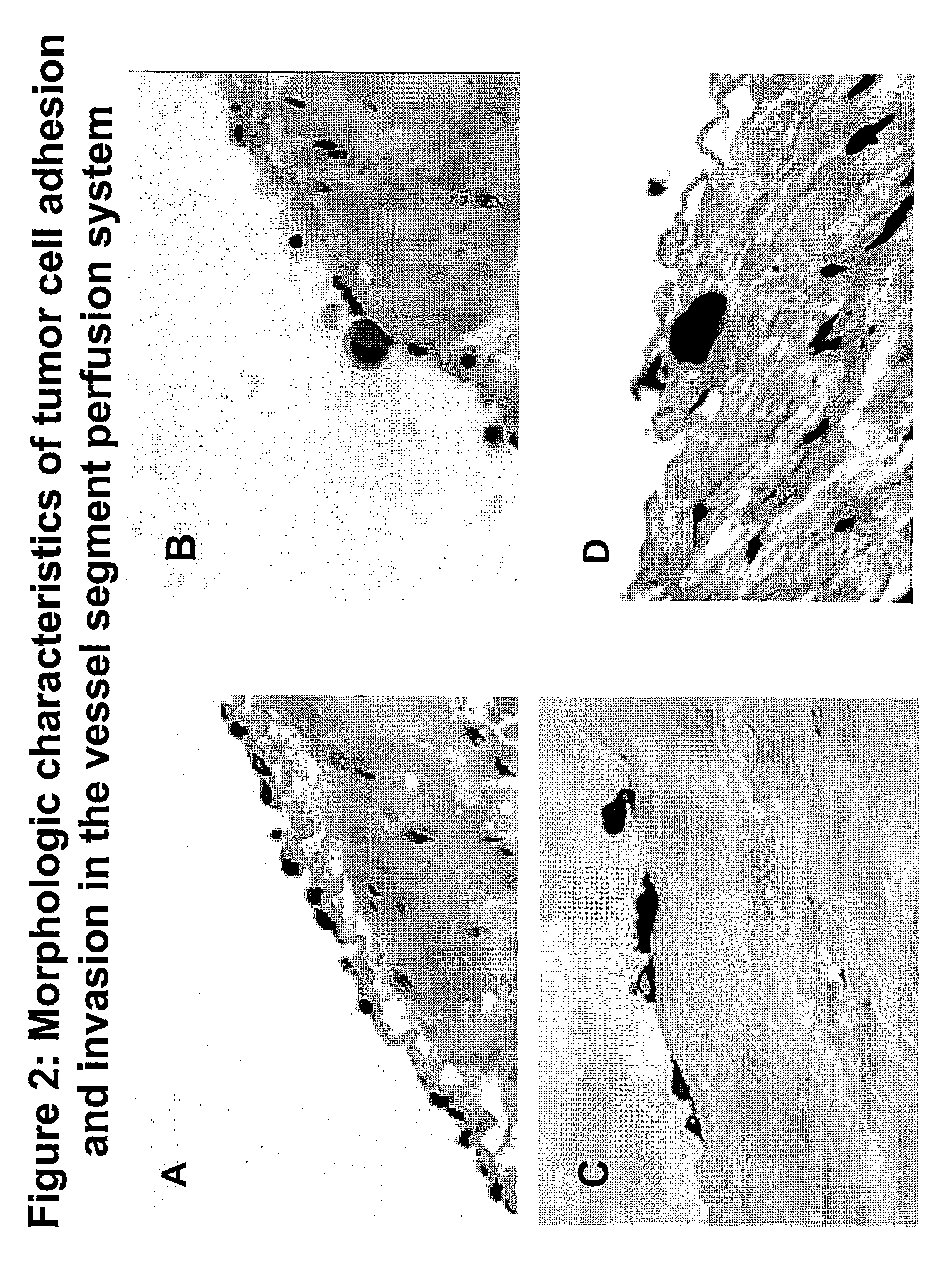 Composition and method for sulfated non-anticoagulant low molecular weight heparins in cancer and tumor metastasis