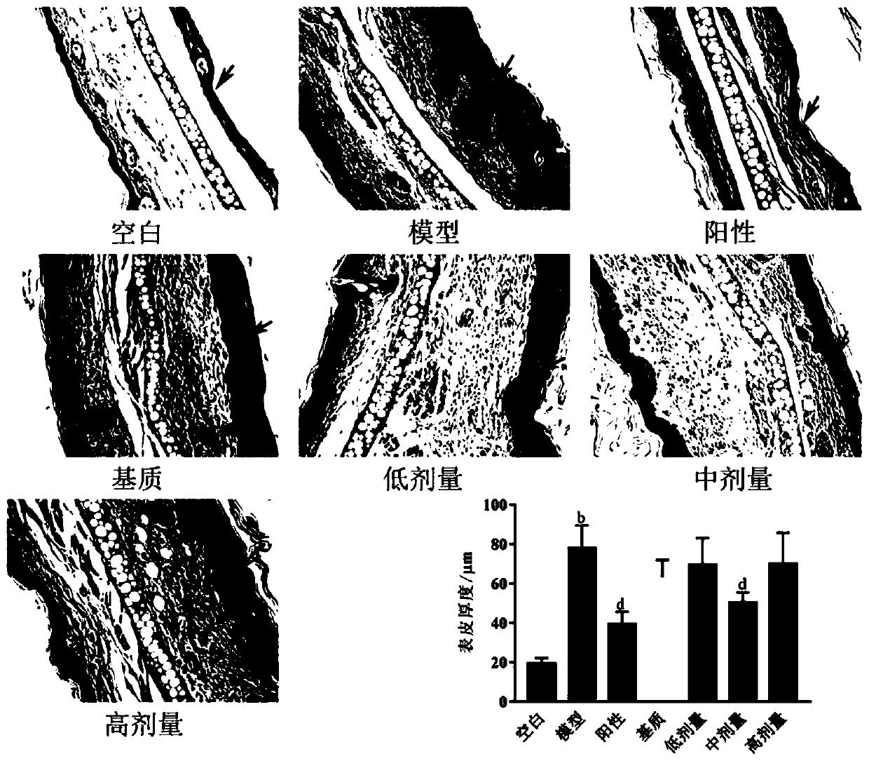 Pharmaceutical composition used for inflammation anaphylaxis skin diseases