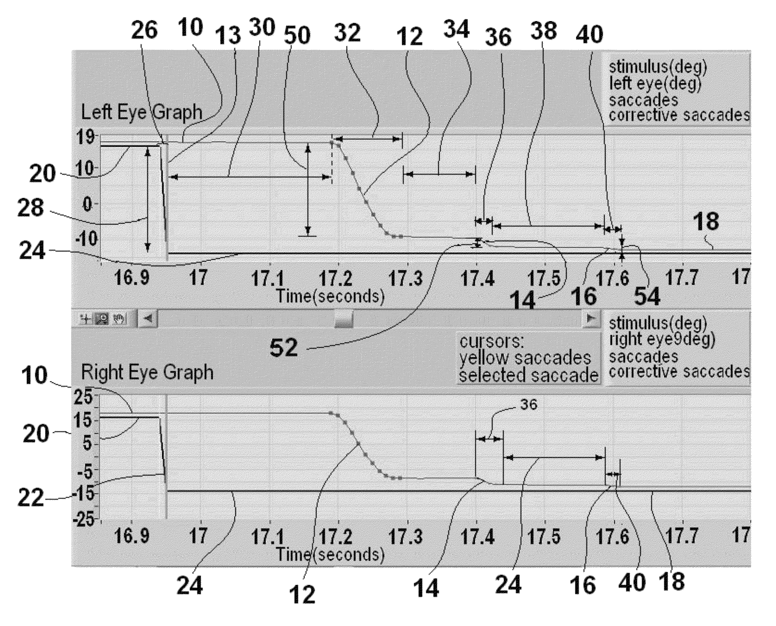 Method and apparatus for corrective secondary saccades analysis with video oculography system