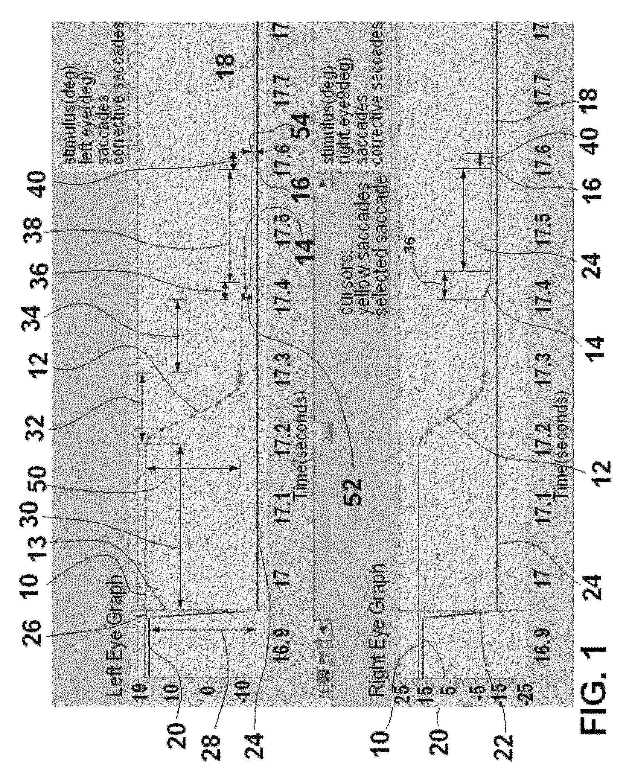 Method and apparatus for corrective secondary saccades analysis with video oculography system