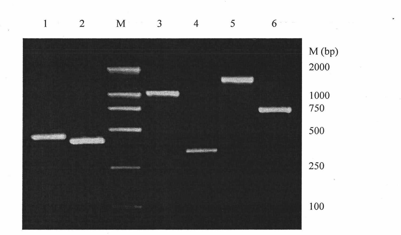 Antibody to beta-amyloid peptide and application thereof