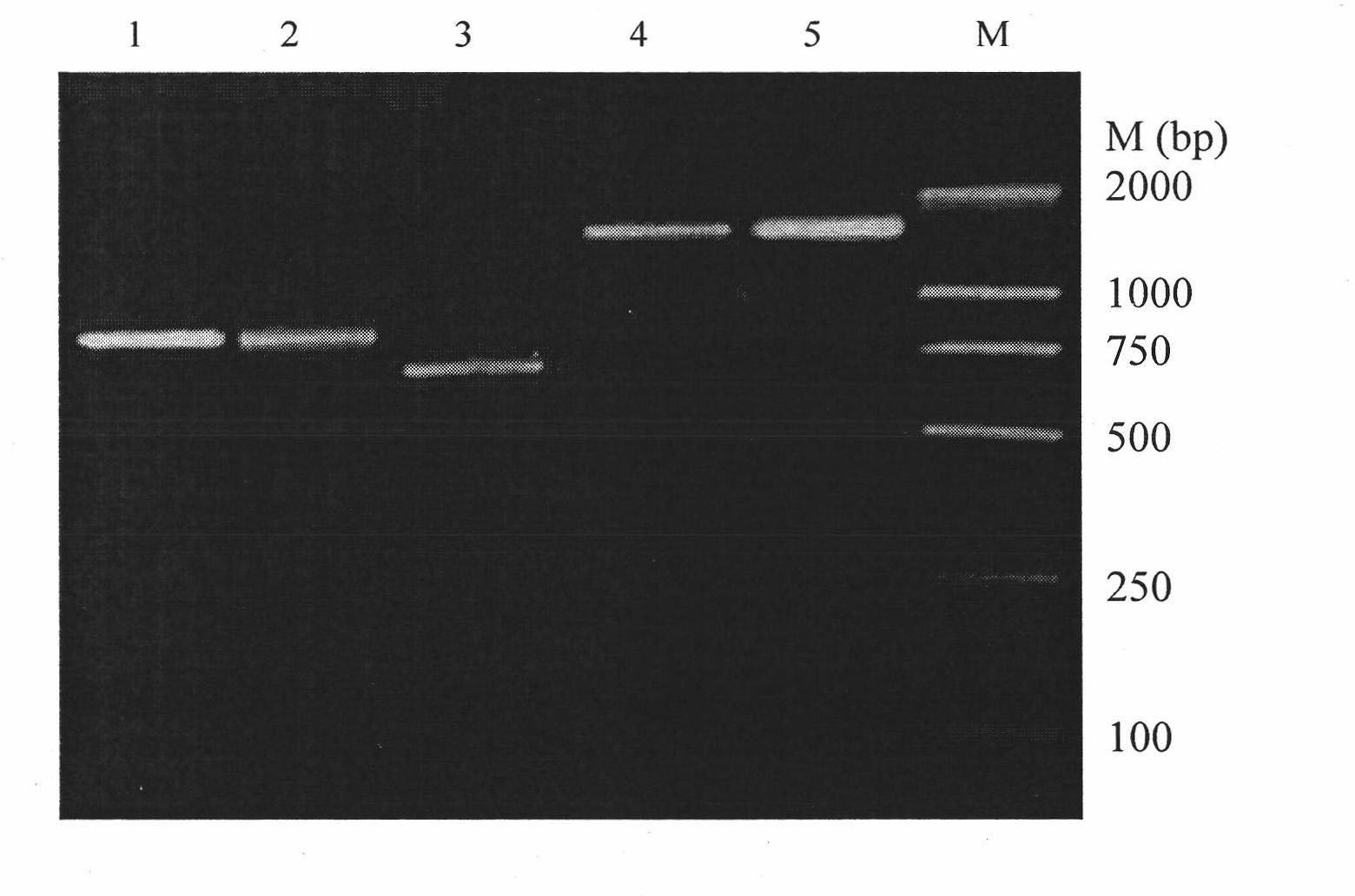 Antibody to beta-amyloid peptide and application thereof