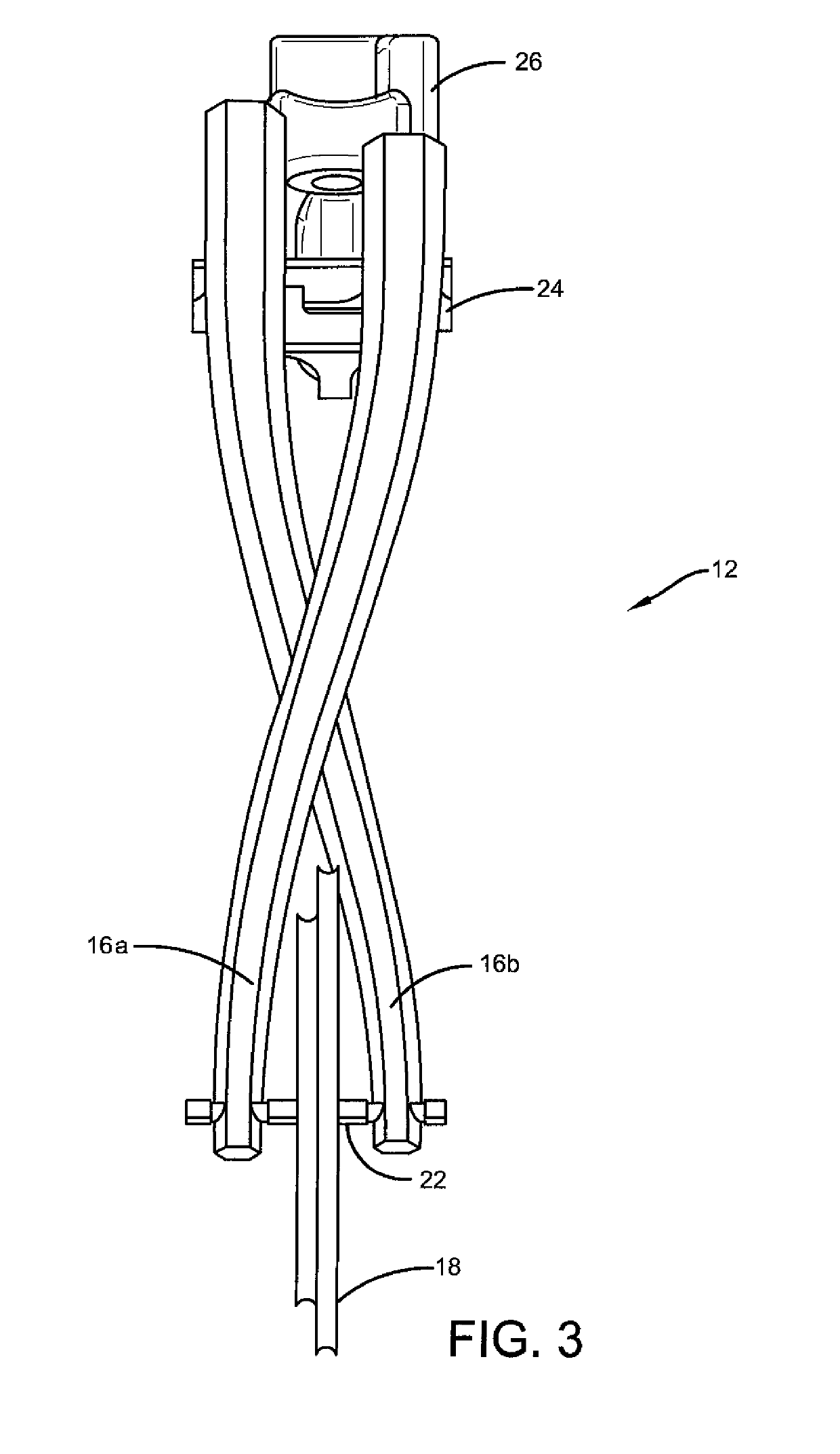 Double helix anti-phased archery limb