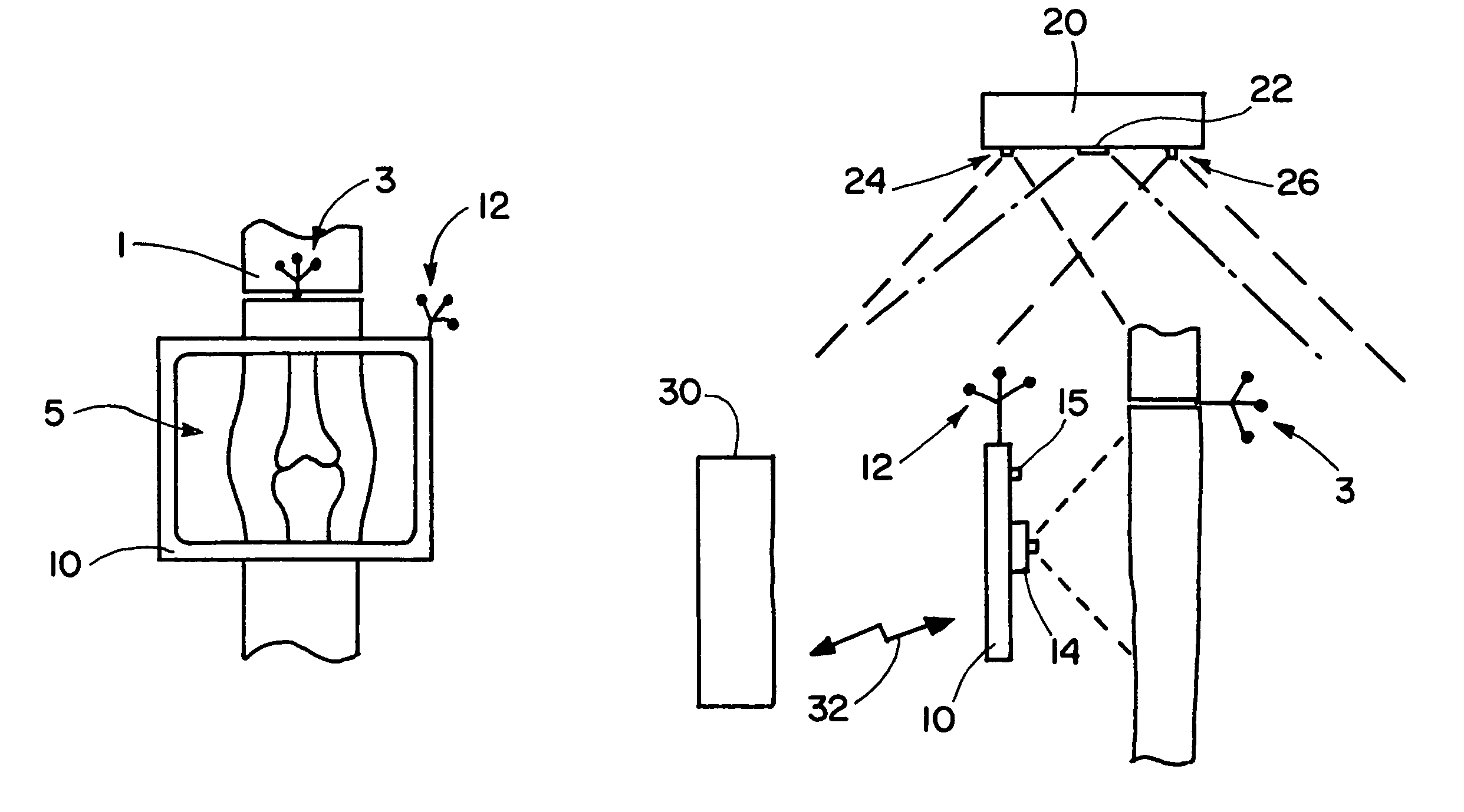 Visualization device and method for combined patient and object image data