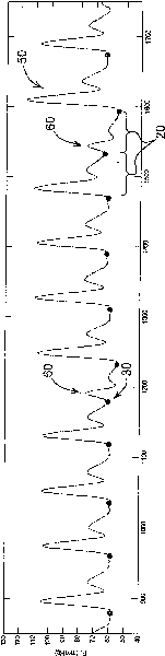 Assessment of preload dependence and fluid responsiveness