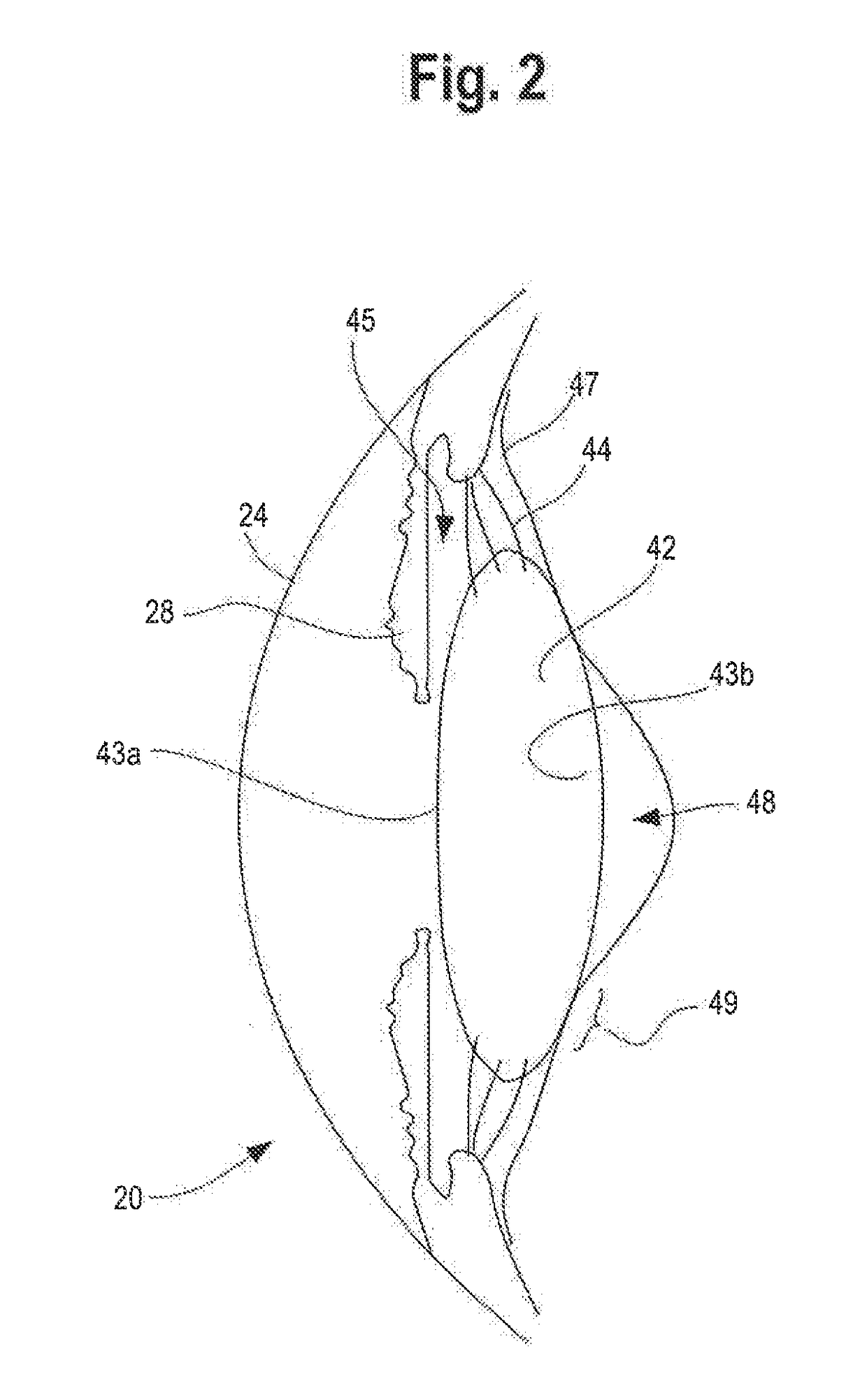 Intraocular lens and methods for implanting the same