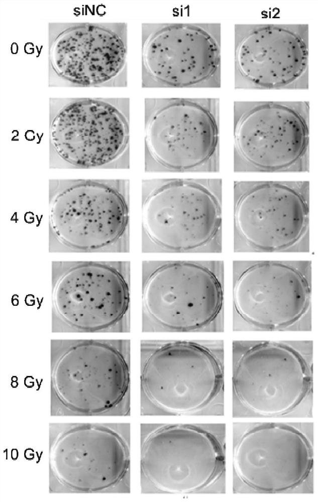 Interference RNA for inhibiting AFAP1-AS1 expression and application of interference RNA in increasing breast cancer radiotherapy sensitivity