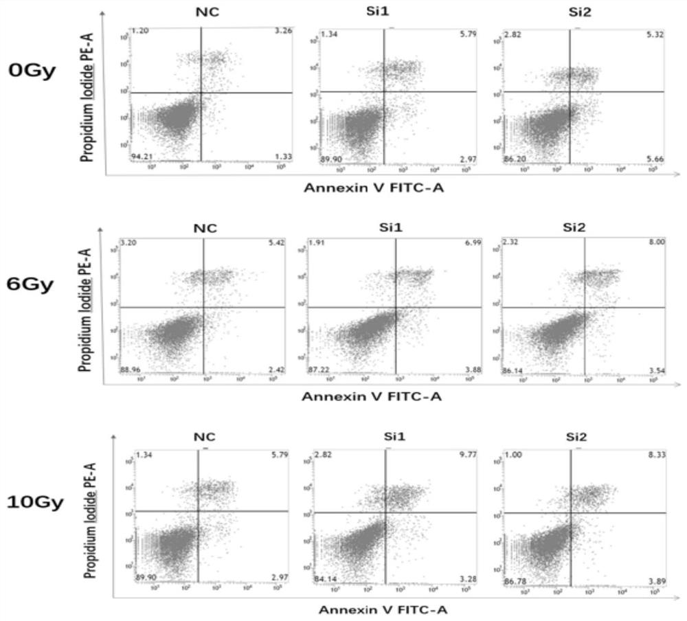 Interference RNA for inhibiting AFAP1-AS1 expression and application of interference RNA in increasing breast cancer radiotherapy sensitivity