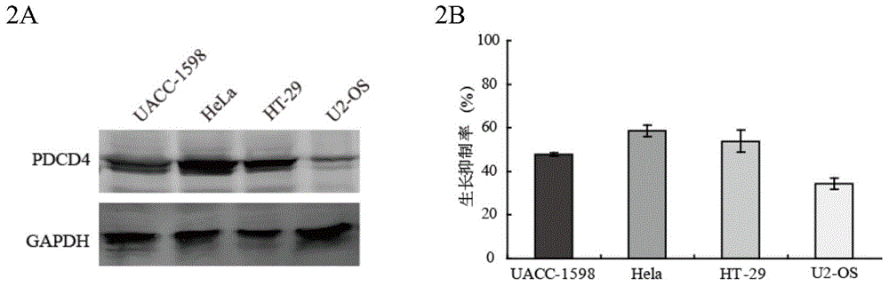 Application of anti-PDCD4 (Programmed Cell Death 4) antibody in preparation of detection reagent for predicting personalized medicine sensitivity of paclitaxel or derivative drug of paclitaxel