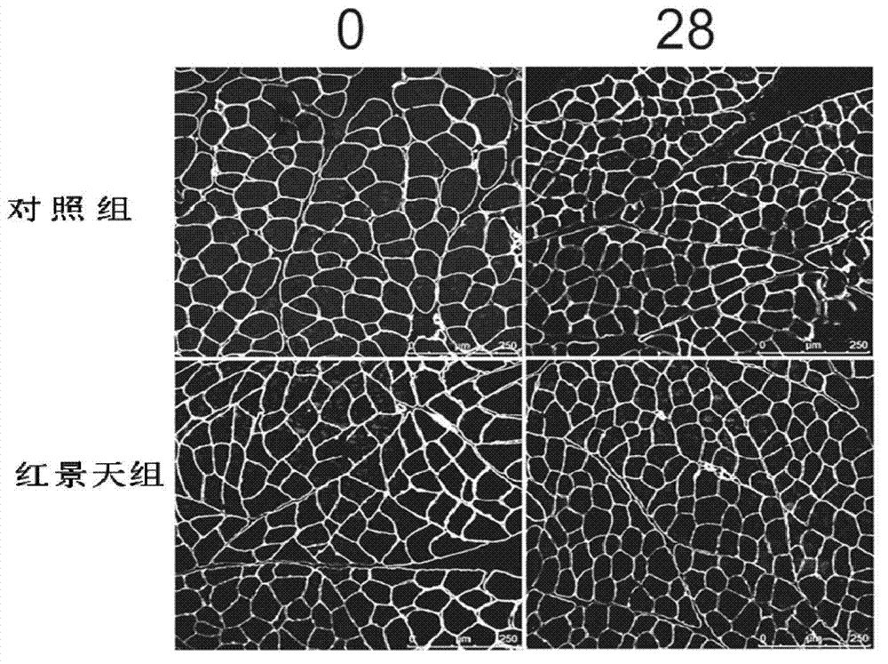 Application of rhodiola rosea in prevention and treatment of amyotrophy disease