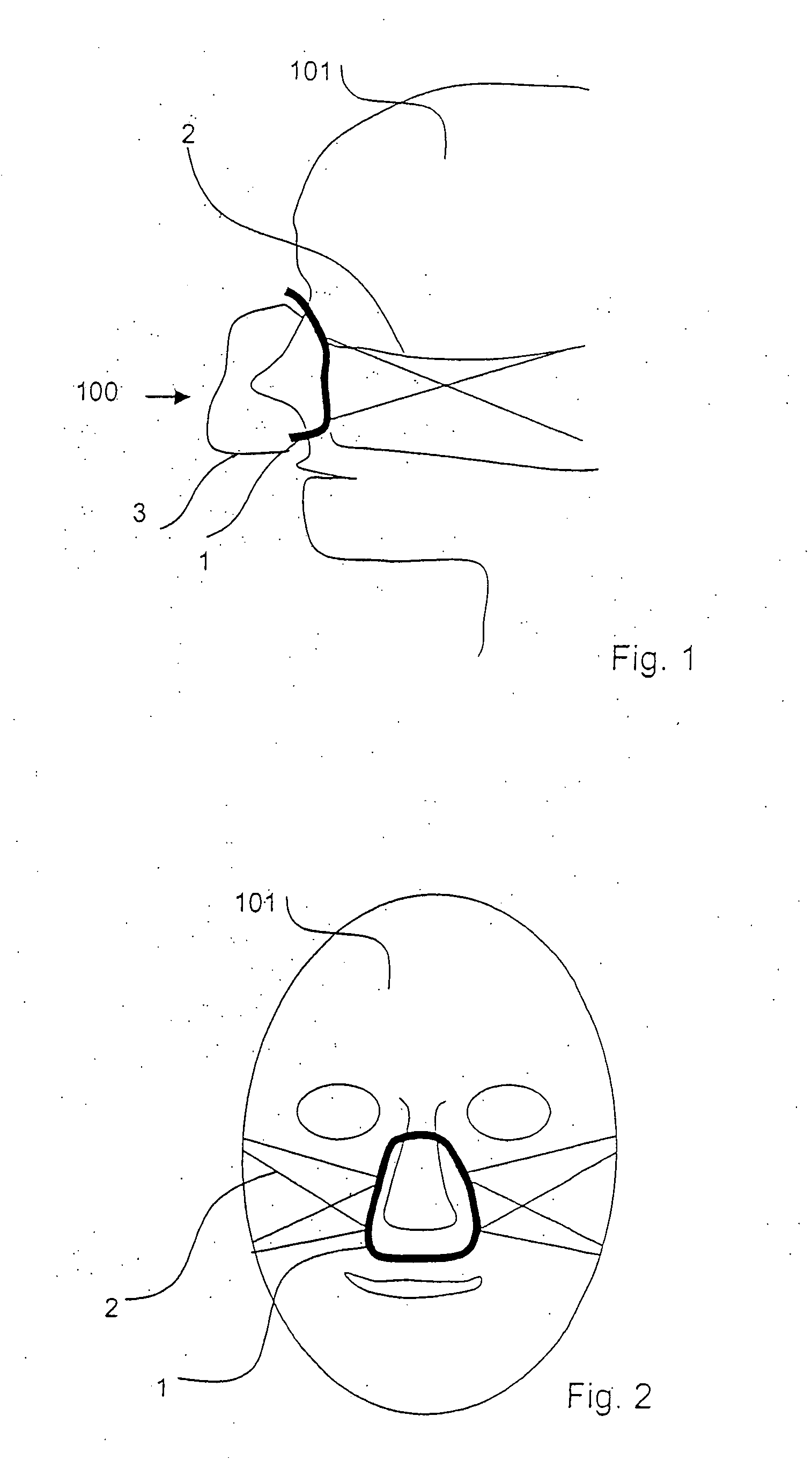 Breathing mask with individual adaptation to the shape of the face