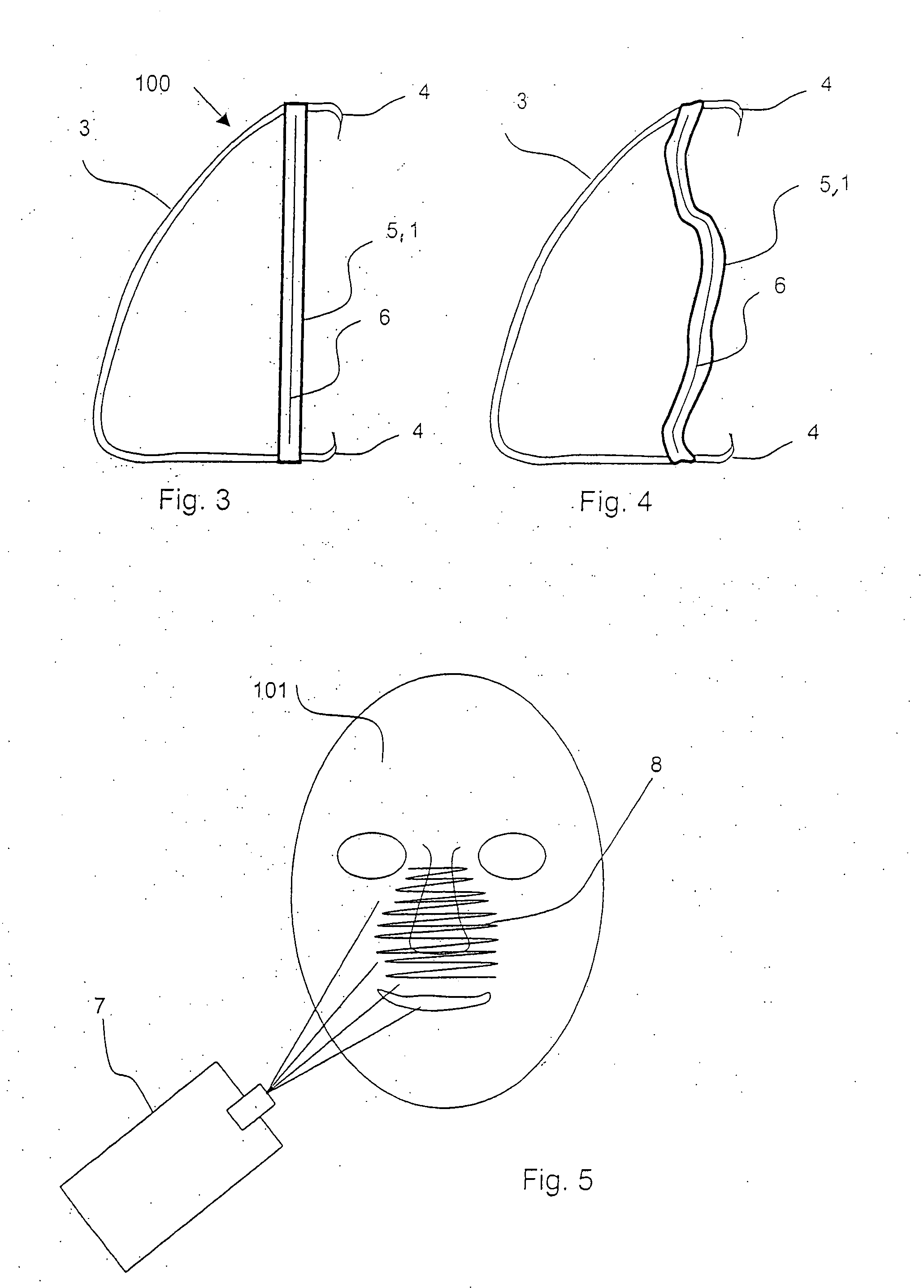 Breathing mask with individual adaptation to the shape of the face