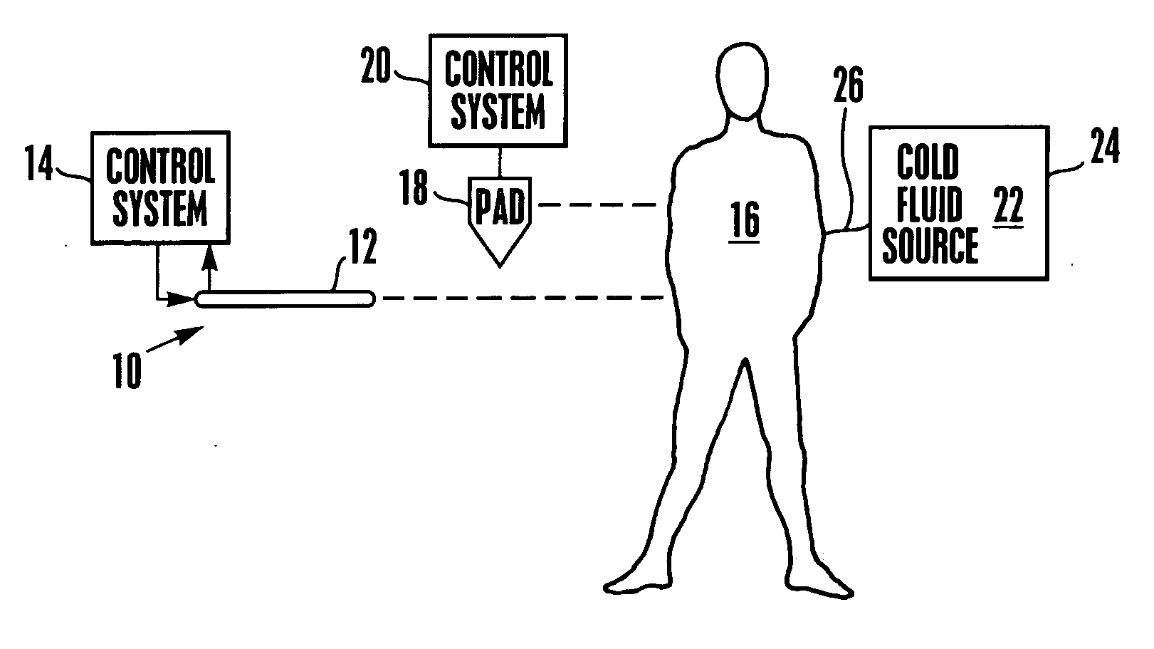 System and method for bringing hypothermia rapidly onboard