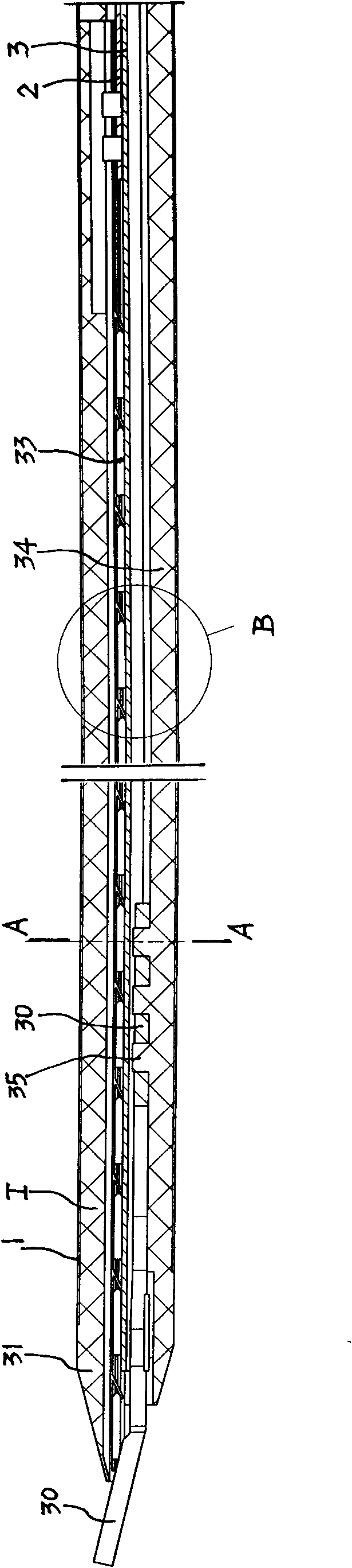 Medical continuously-applied titanium clip