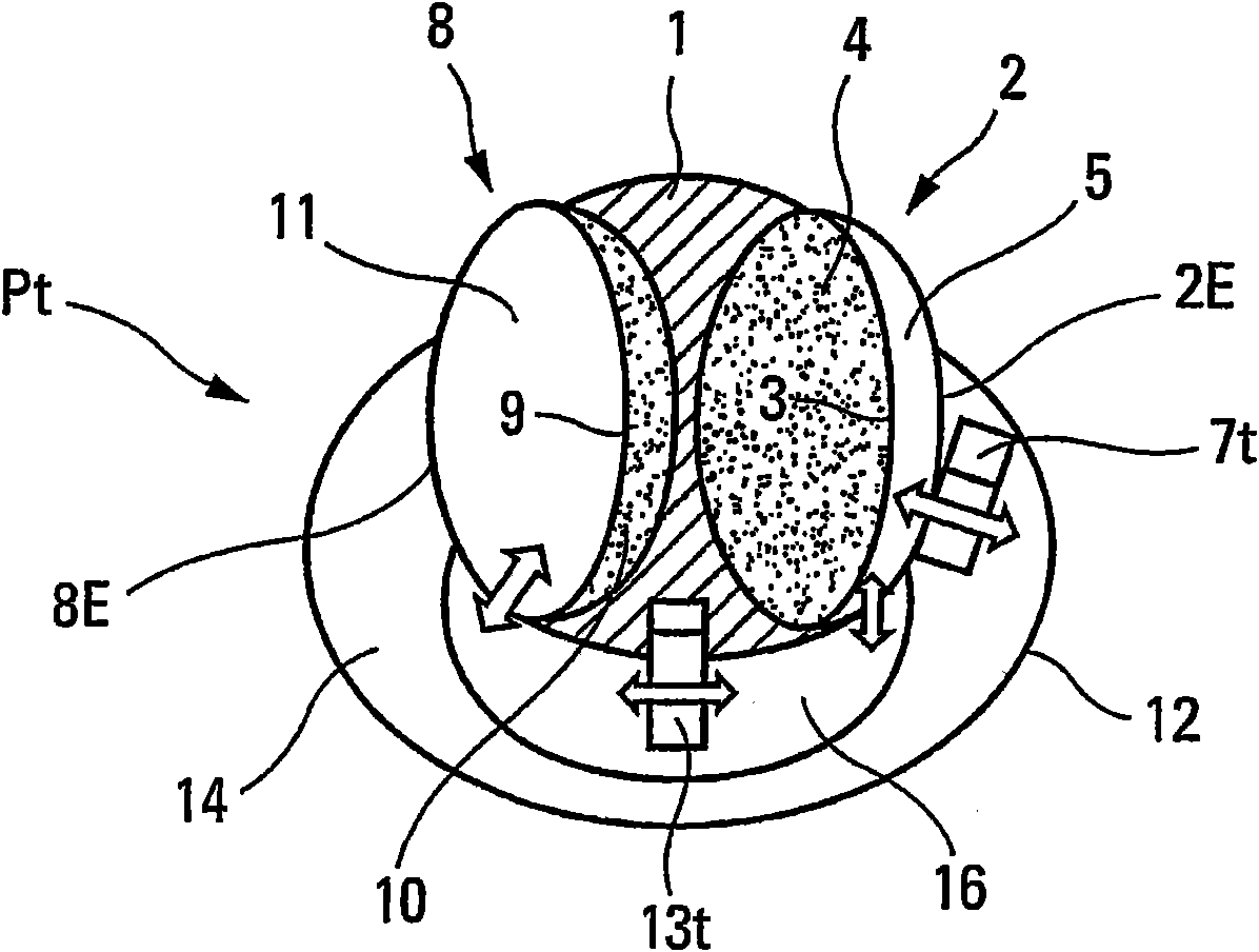 Implantable single-piece artificial heart