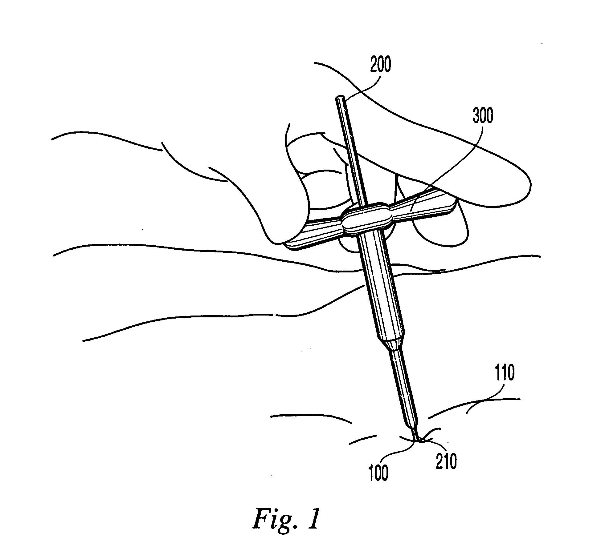 Sequential dilator system