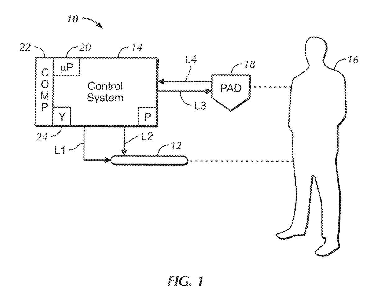 Heat exchange system for patient temperature control with easy loading high performance peristaltic pump