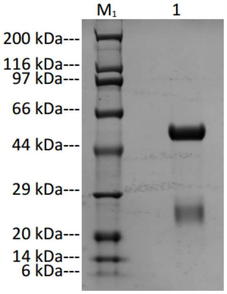 A kind of anti-Aspergillus galactomannan monoclonal antibody and its application