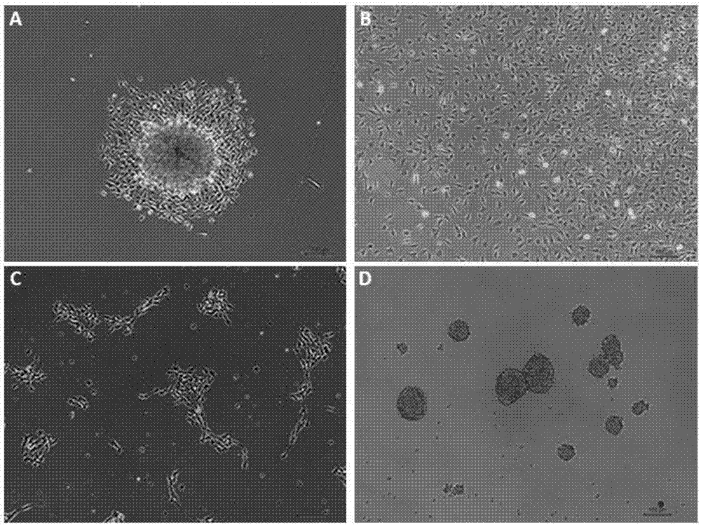 Method for isolating, culturing and differentiating neural crest stem cells from DRG (dorsal root ganglion)