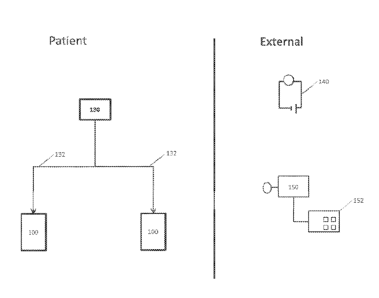 Neuromodulation device