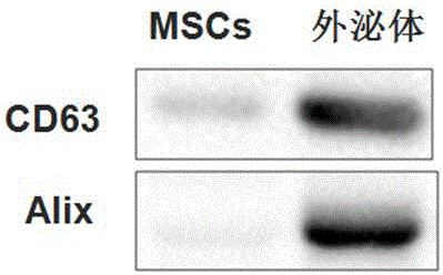 Application of mesenchymal stem cell-derived exosome in preparing drug or preparation for treating preeclampsia