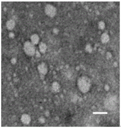 Application of mesenchymal stem cell-derived exosome in preparing drug or preparation for treating preeclampsia