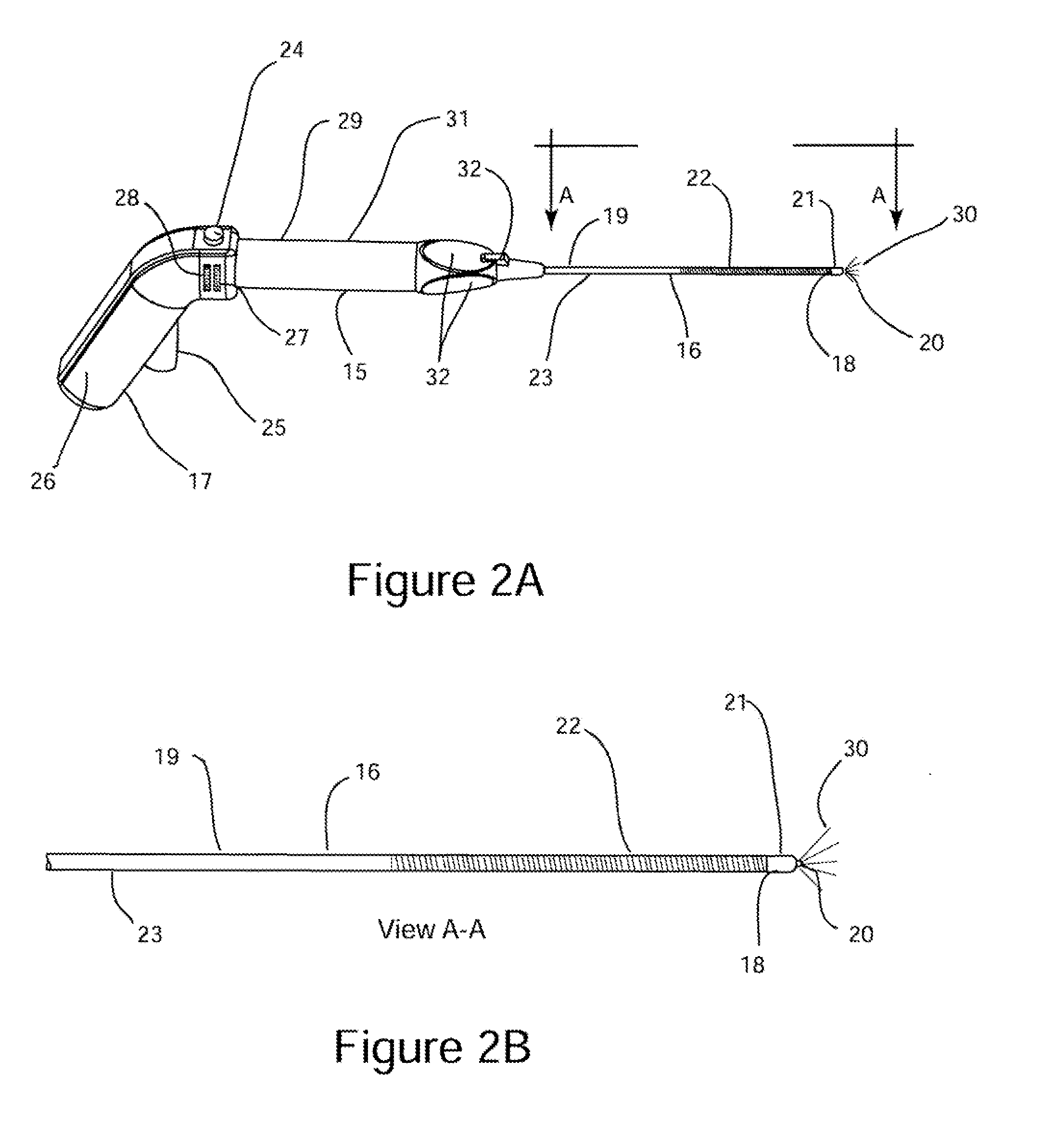 Apparatus and method for treating rhinitis