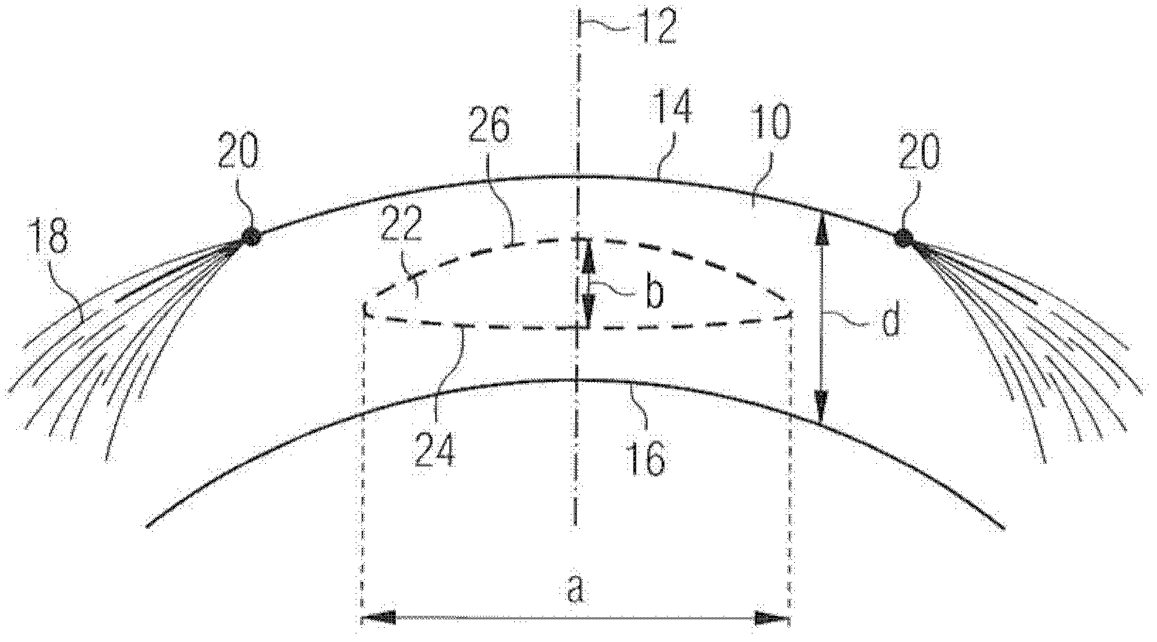 Device for laser-surgical ophthalmology