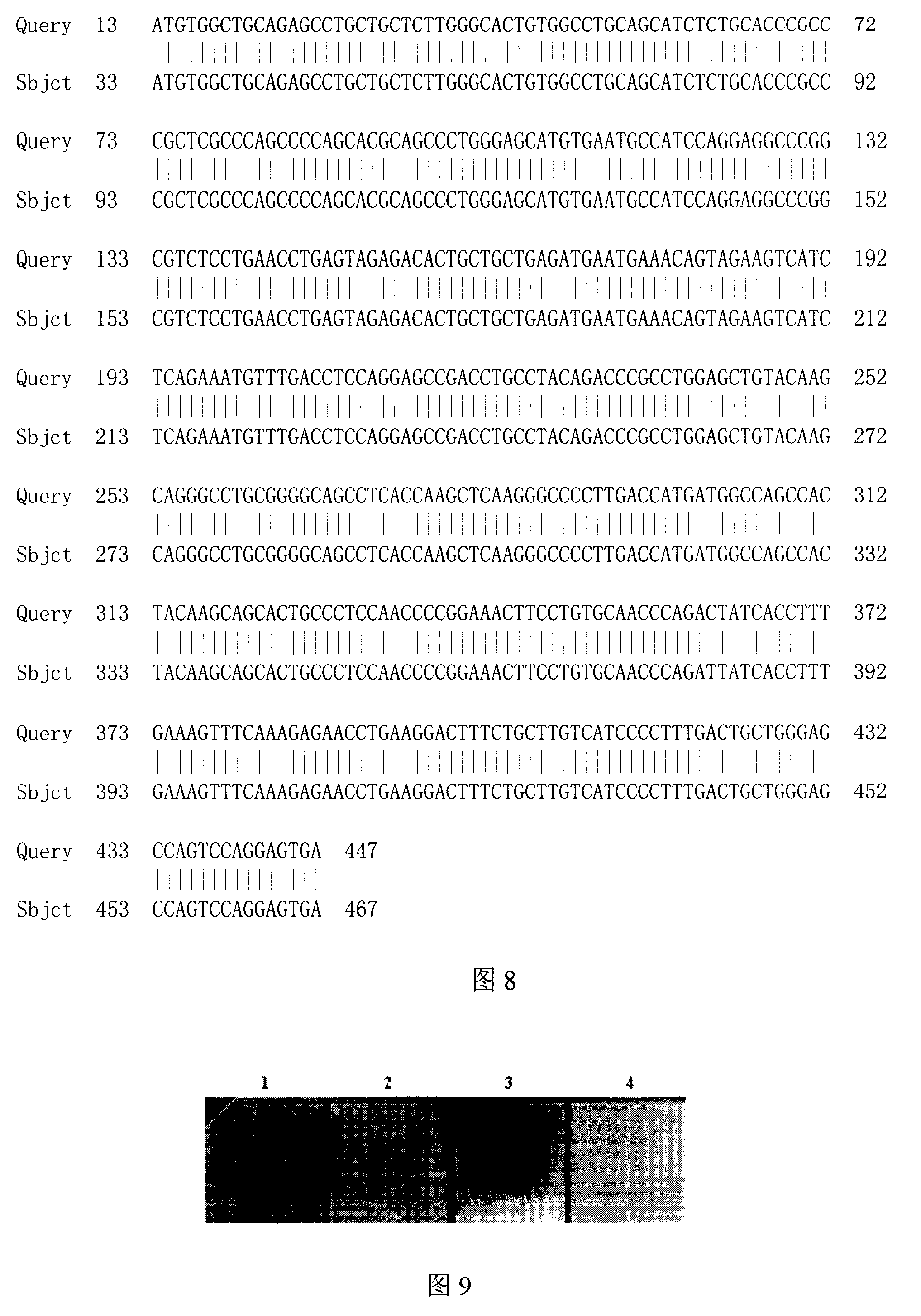 Acute promyelocytic leukemia DNA vaccine, preparing method thereof and applications