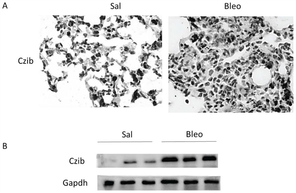 Application of reagent for down-regulating Czib gene expression in preparation of medicine for treating or improving pulmonary fibrosis