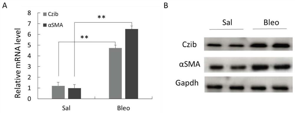 Application of reagent for down-regulating Czib gene expression in preparation of medicine for treating or improving pulmonary fibrosis