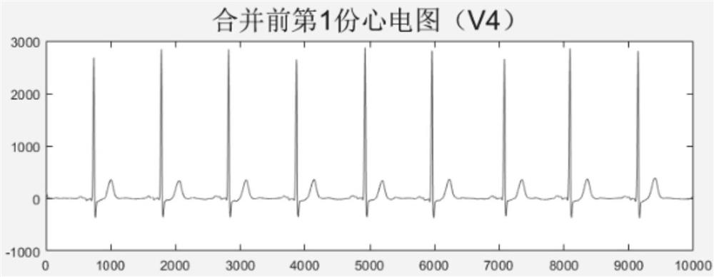 XML document standardization method and system for storage of various electrocardiosignals