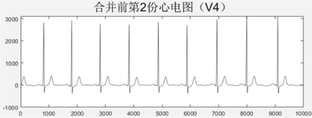 XML document standardization method and system for storage of various electrocardiosignals