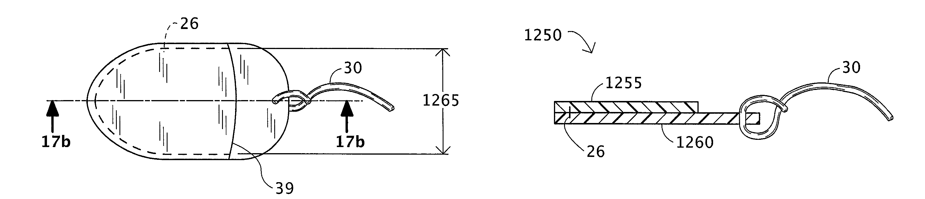 Vaginal drug delivery system and method