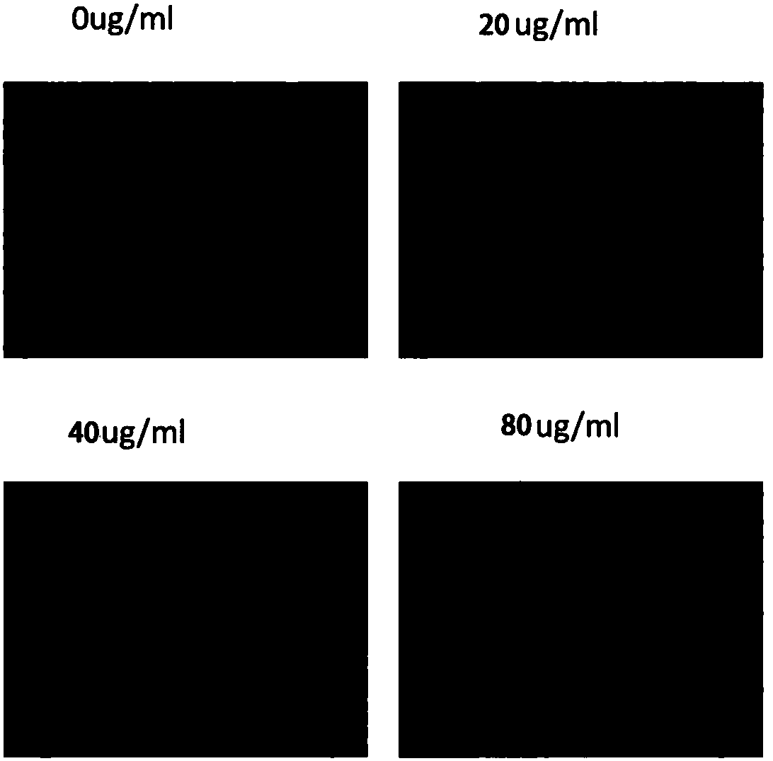 Novel recombinant bee venom polypeptide as well as preparation method and application of novel recombinant bee venom polypeptide