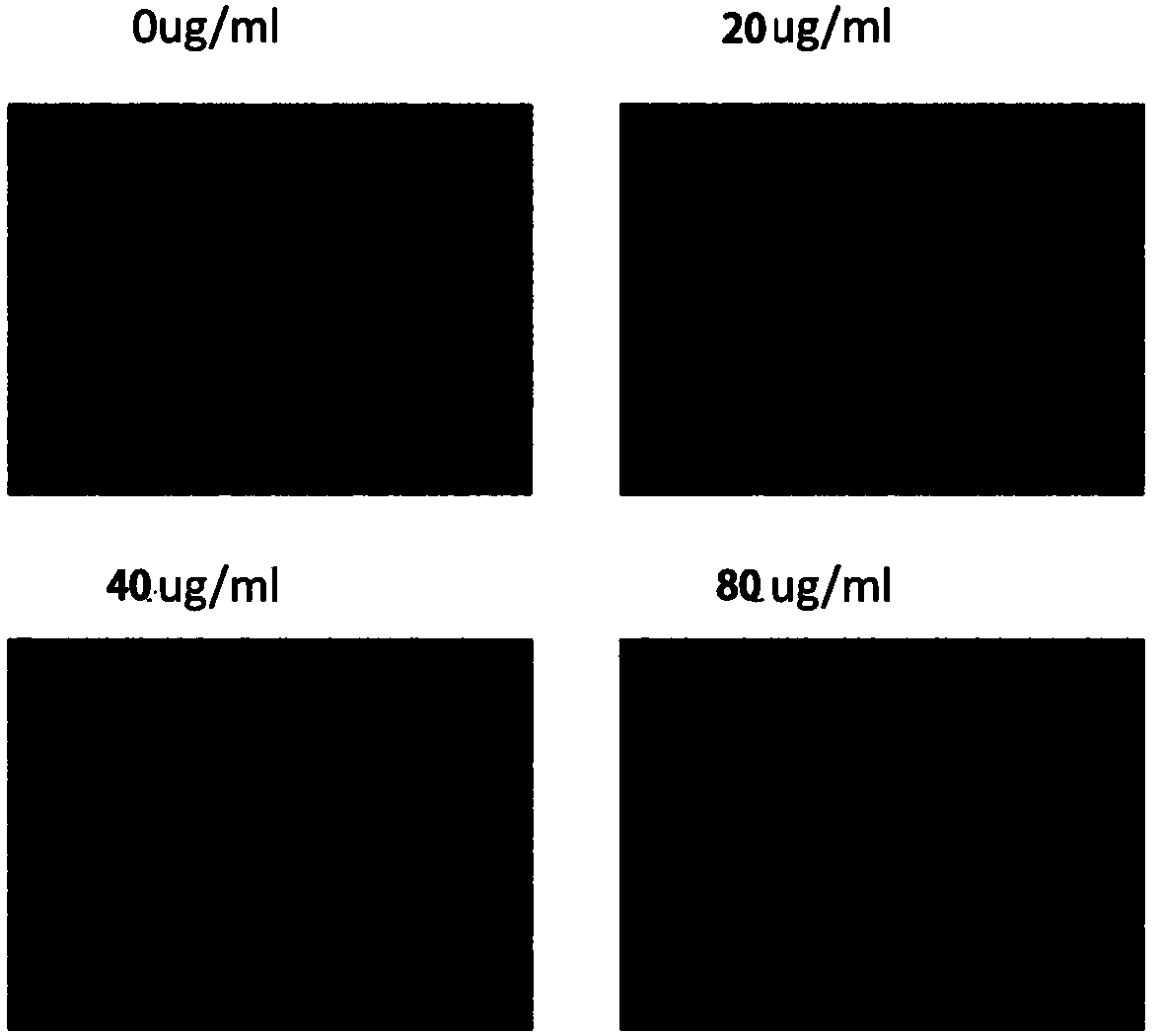 Novel recombinant bee venom polypeptide as well as preparation method and application of novel recombinant bee venom polypeptide